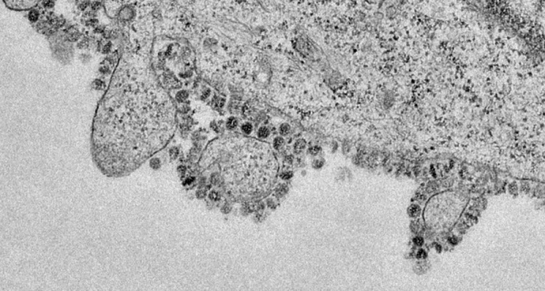 Размножение коронавируса впервые показали на фото
