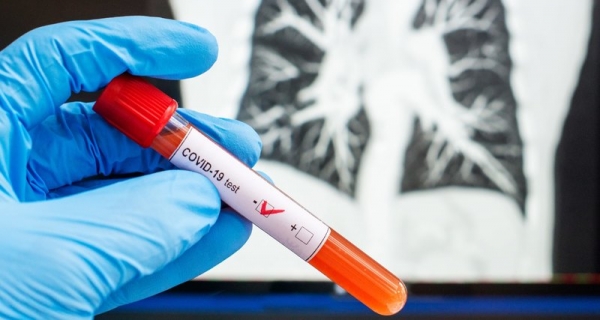 «Яндекс» начал доставку тестов на коронавирус