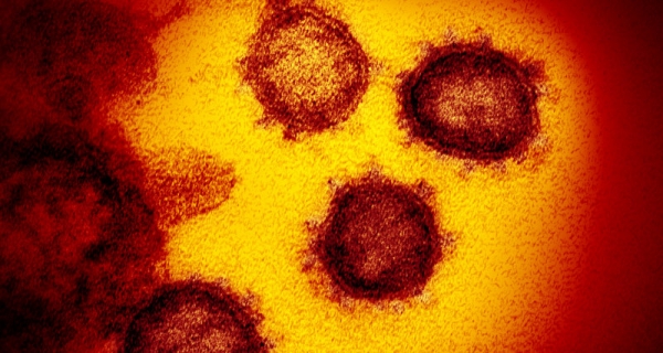 Разведка США высказалась о происхождении вируса SARS-CoV-2