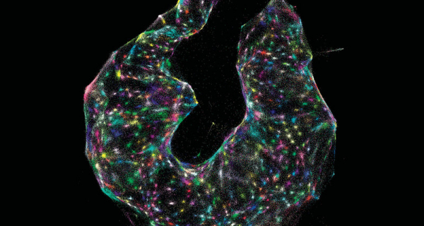 Микроскопия без микроскопа: красота кодирования генов