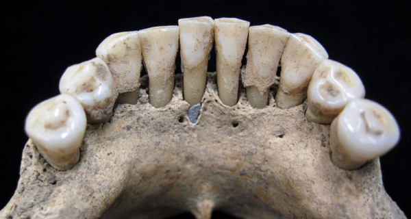 1000-летний зубной камень раскрыл тайну старинных рукописей