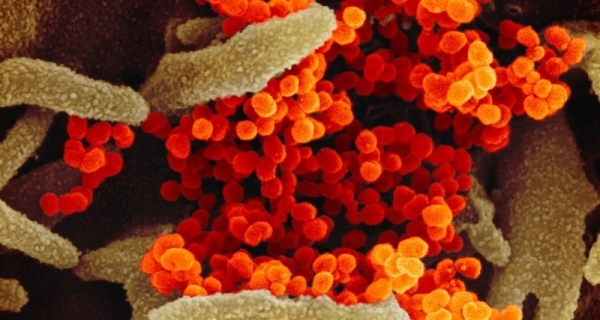 Названы клетки, наиболее восприимчивые к коронавирусу: плохие новости